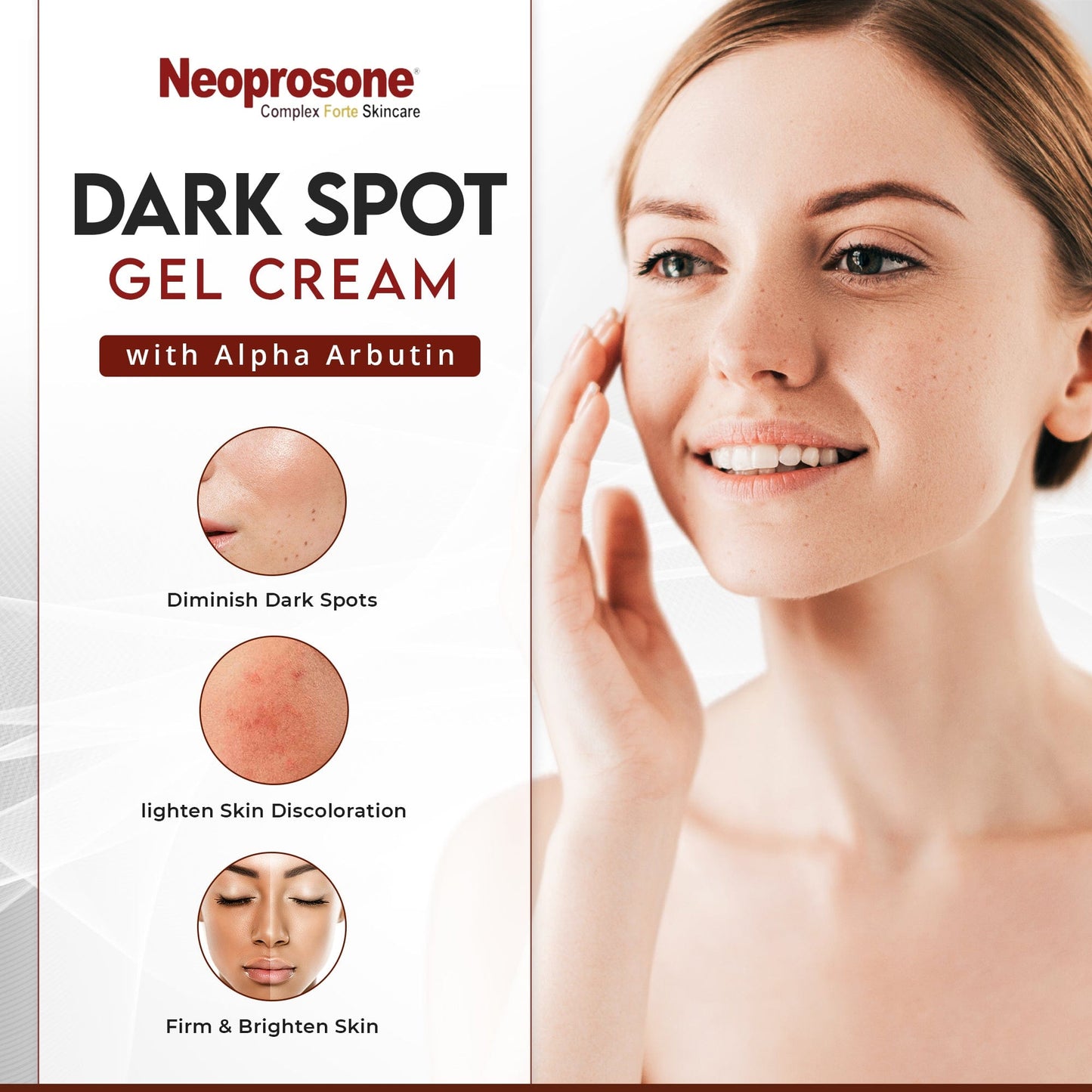 Neoprosone Dark Spot Remover Gel Cream - 1 Fl oz / 30ml Mitchell Brands - Mitchell Brands - Hautaufhellung, Hautaufhellung, Verblassen dunkler Flecken, Shea Butter, Haarwuchsmittel