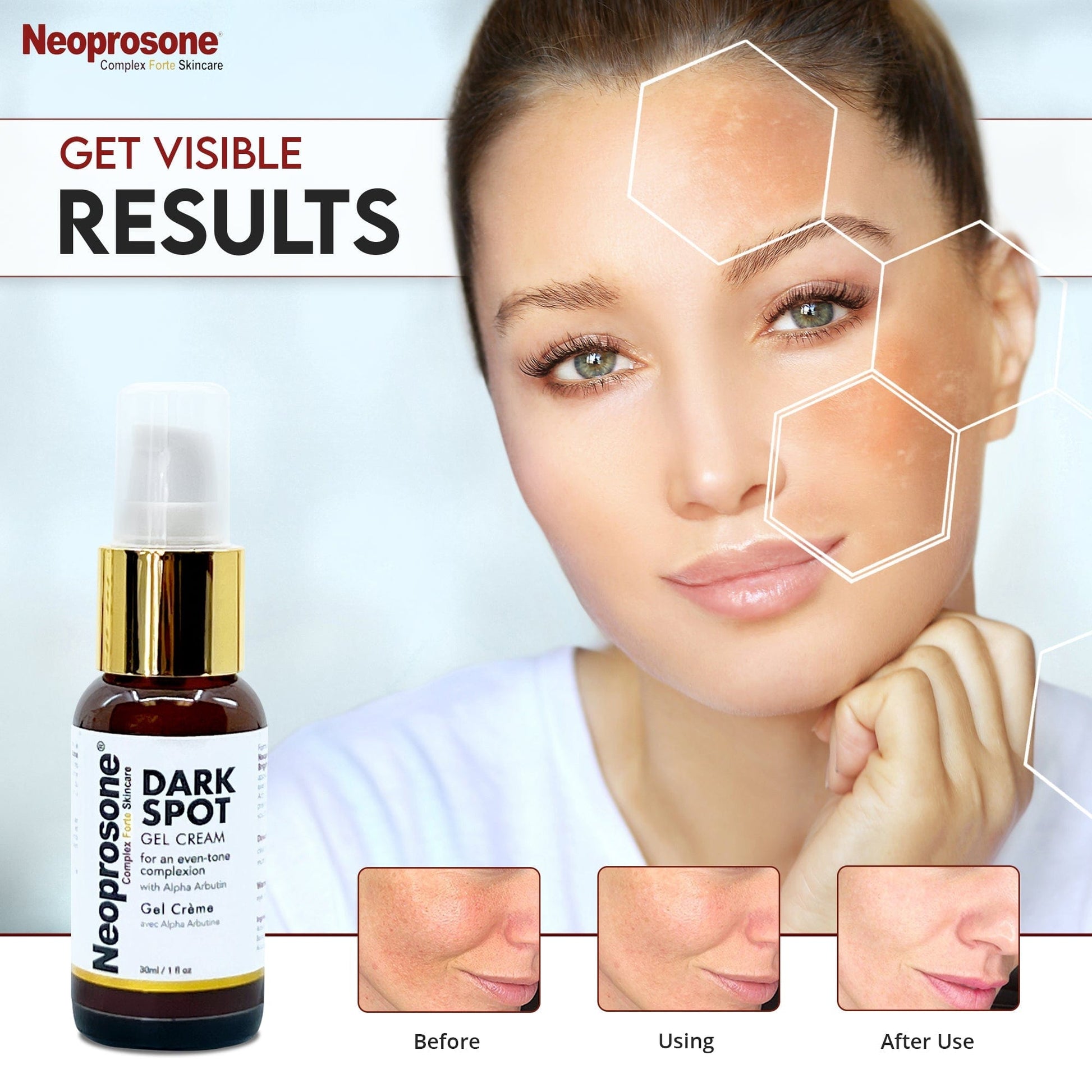 Neoprosone Dark Spot Remover Gel Cream - 1 Fl oz / 30ml Mitchell Brands - Mitchell Brands - Hautaufhellung, Hautaufhellung, Verblassen dunkler Flecken, Shea Butter, Haarwuchsmittel